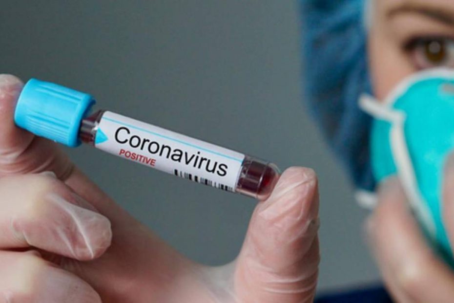Caminhoneiros são diagnosticados com coronavírus